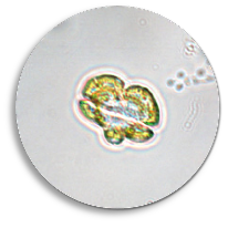 Karenia brevis microscope